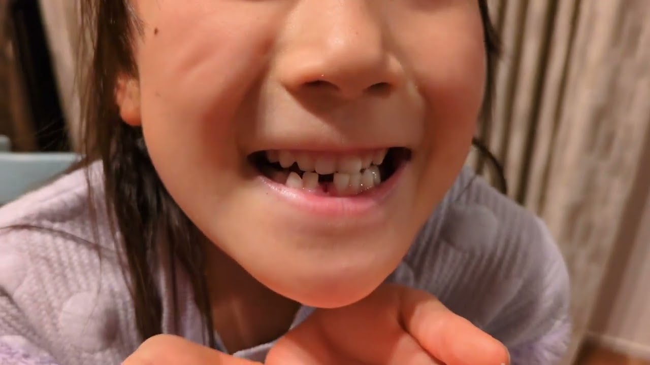 Tiny tooth 1本目 (7歳11ヶ月)