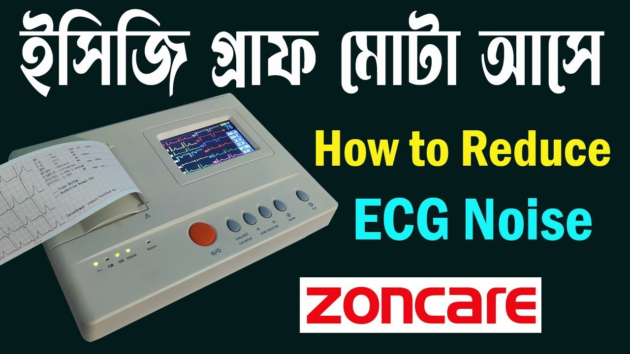How to reduce ECG Noice. Zoncare ZQ-1203G. Time Medical 360