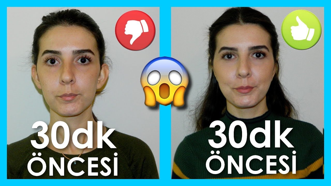 Kepçe Kulak Estetiği Oldum !😱 (Önceden Bilmeniz Gerekenler) ♥