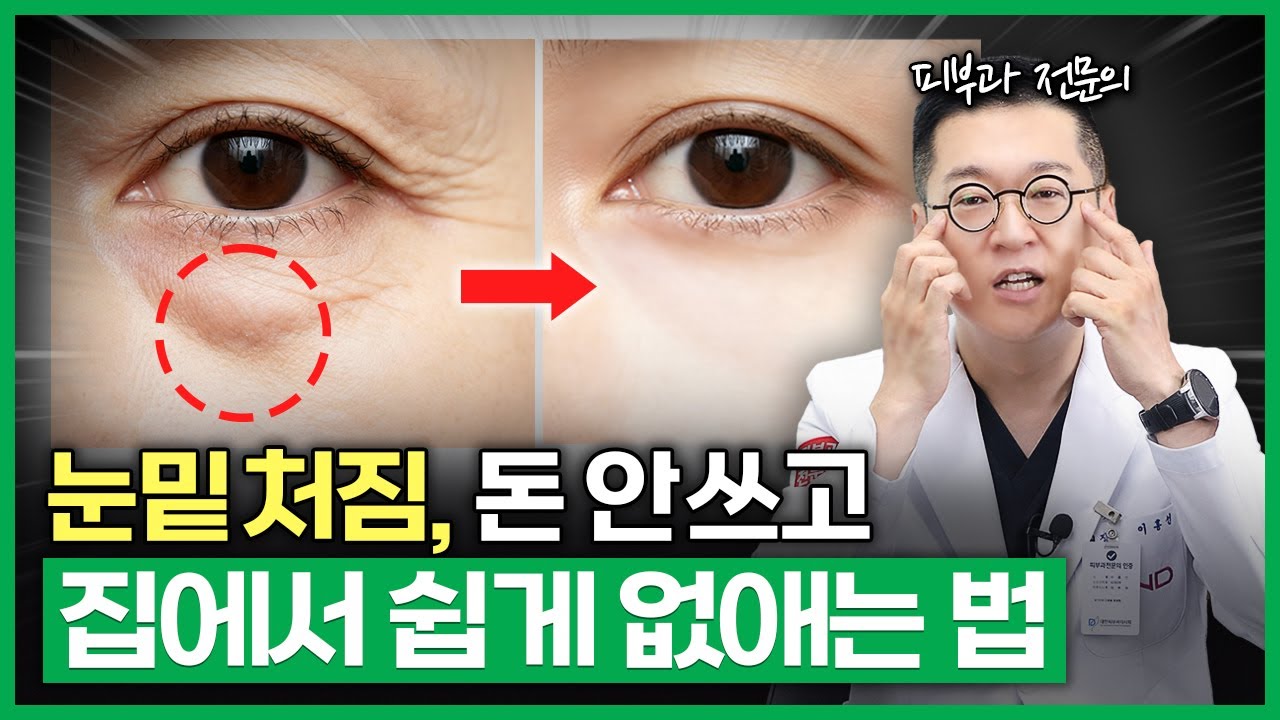 눈밑 지방, 눈밑 처짐 집에서 ‘이렇게’ 해결하세요! 눈밑 처짐 마사지 꿀팁 공개! | 눈밑처짐, 눈밑지방 홈케어, 동안얼굴운동