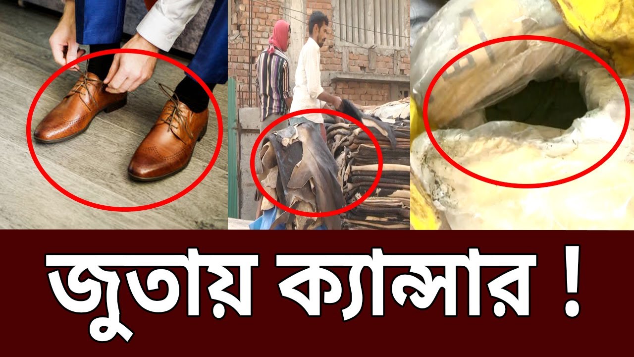 জুতায় ক্যান্সারের জীবাণু | Ghotonar Ontorale | EP 45 | Mytv Show