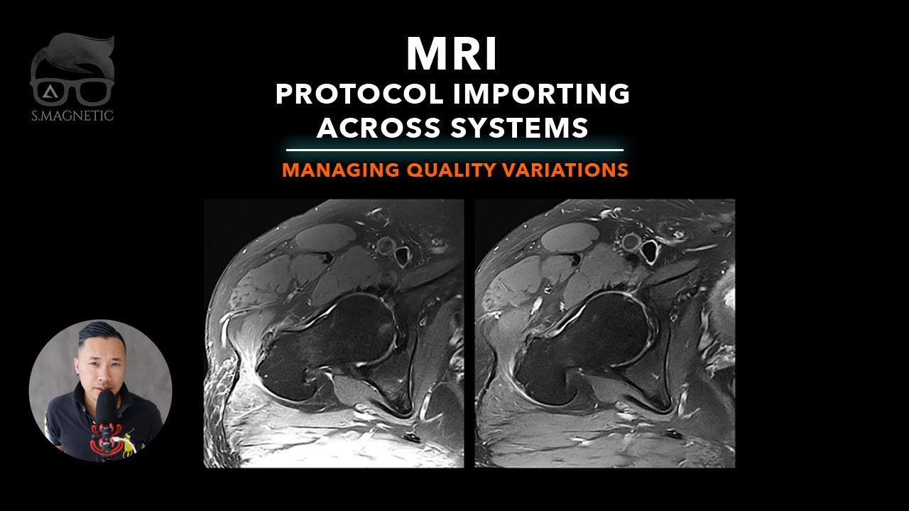 MRI – PROTOCOL IMPORTING ACROSS SYSTEMS: MANAGING QUALITY VARIATIONS