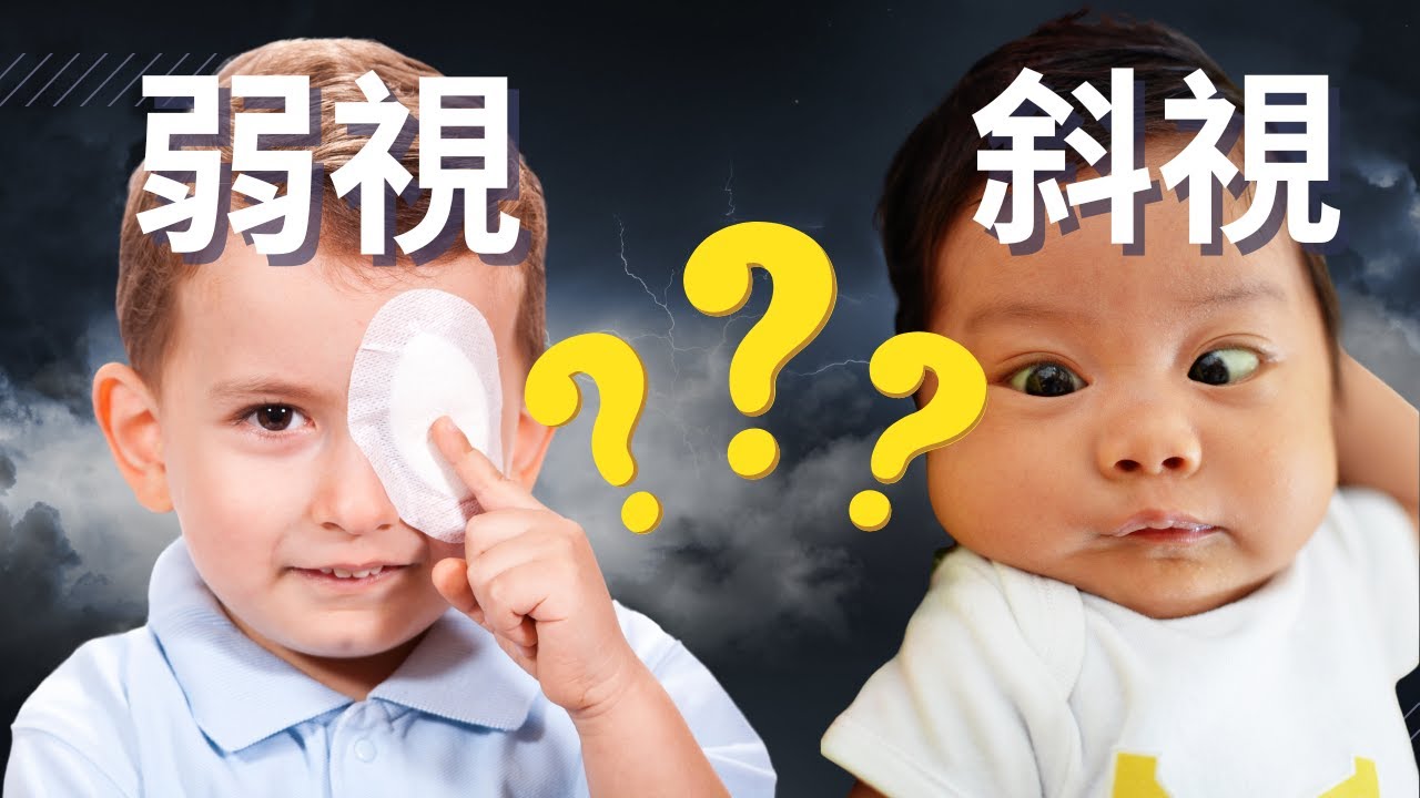 斜視 vs 弱視? 斜視分哪幾種？斜視的原因？斜視如何造成復視和弱視？