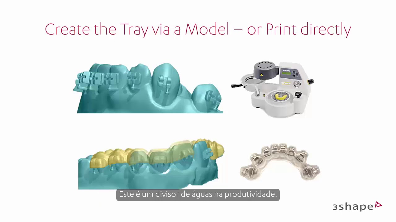 3Shape Ortho Analyzer - Introdução à colagem indireta com base na configuração
