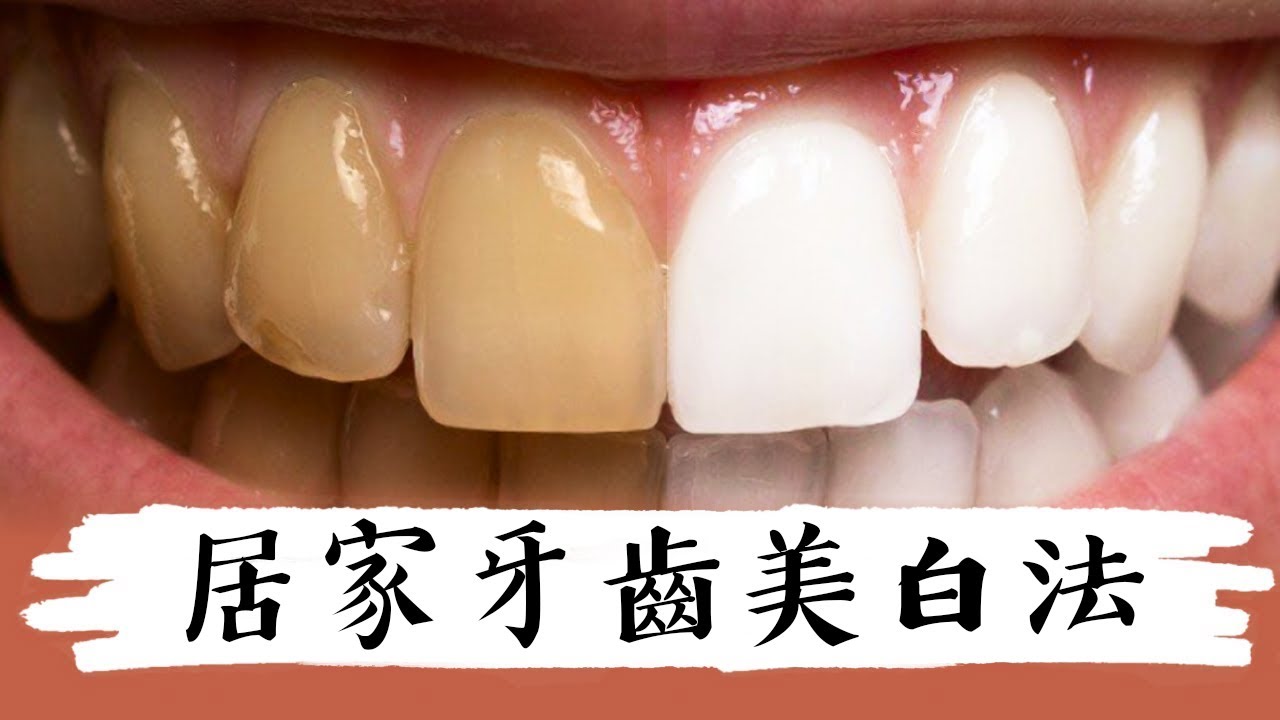 牙齒美白,簡單2成分,很有效,自然療法,柏格醫生 Dr Berg