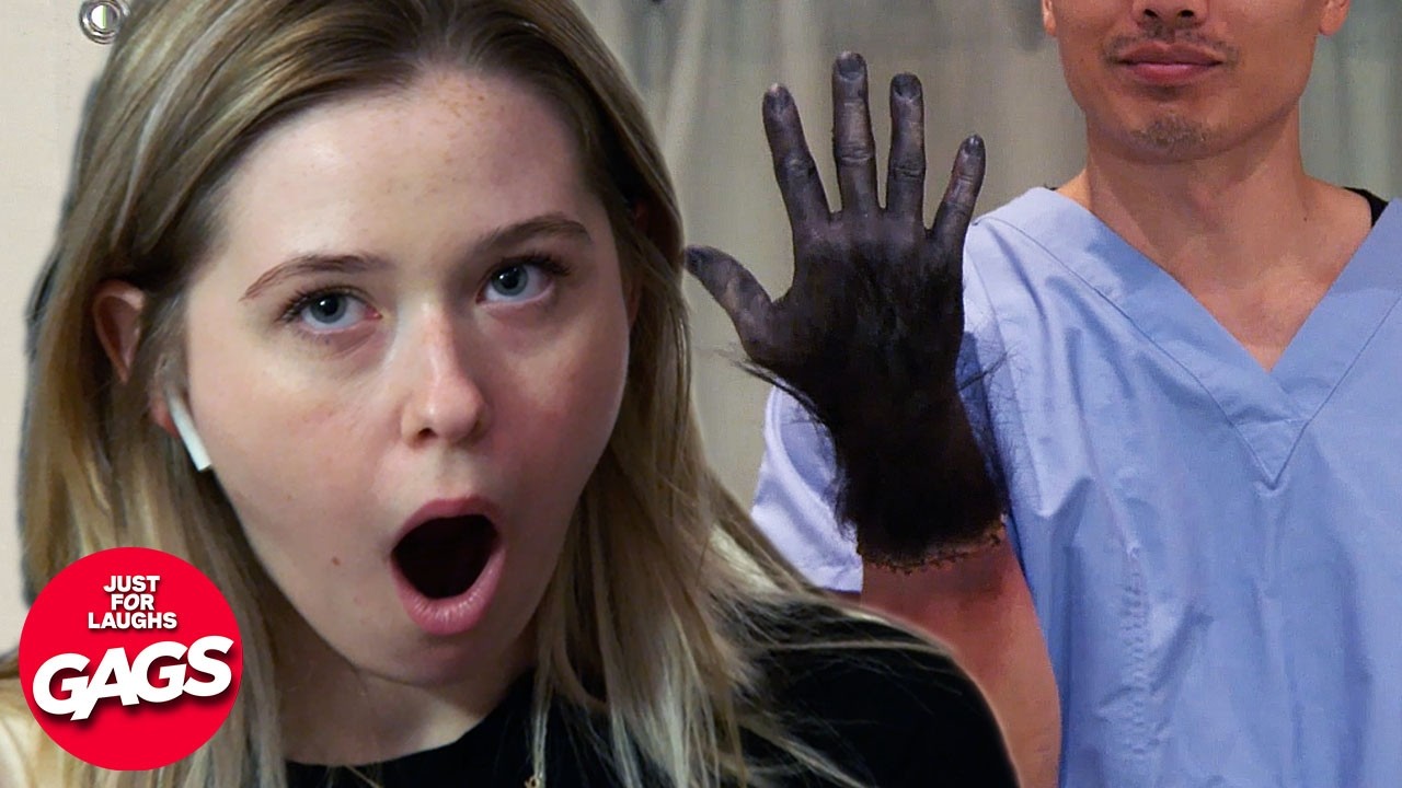 Hand Transplant Goes HORRIBLY Wrong | Just For Laughs Gags