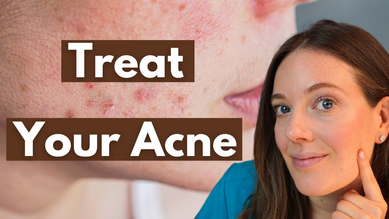 Acne Causes and Treatments | Dermatology Advice