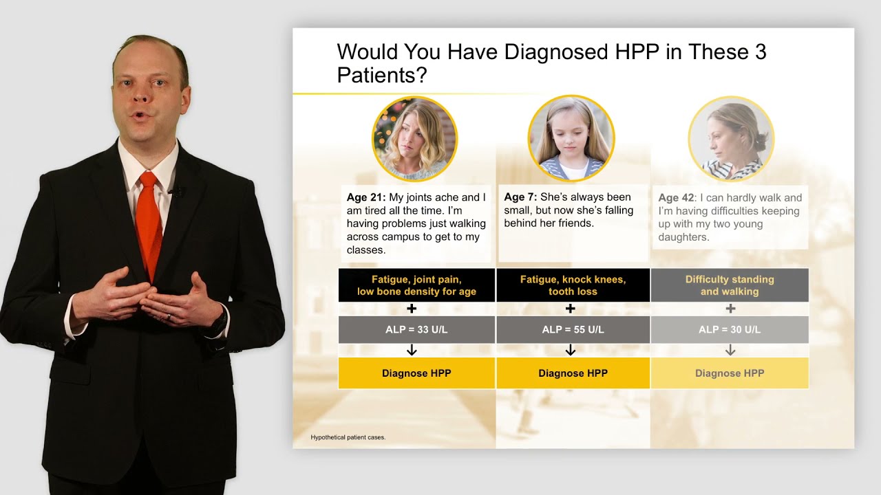 Diagnosing Hypophosphatasia