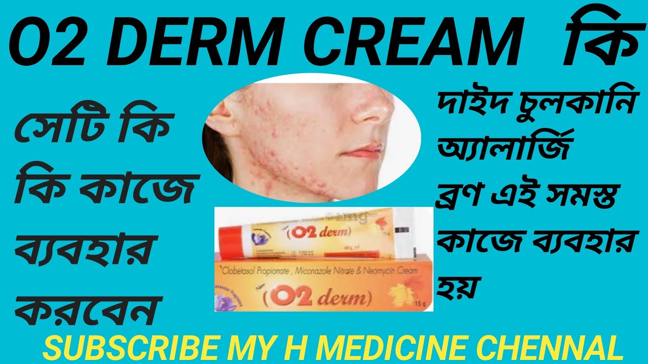 O2 DERM CREAM USE IN BANGLA#O2 DERM CREAM কি কি কাজে ব্যবহার করবেন