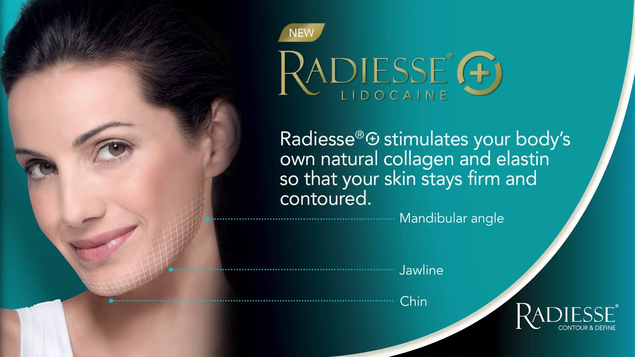 Merz Radiesse® @ Iconic Medical Skin & Laser Center