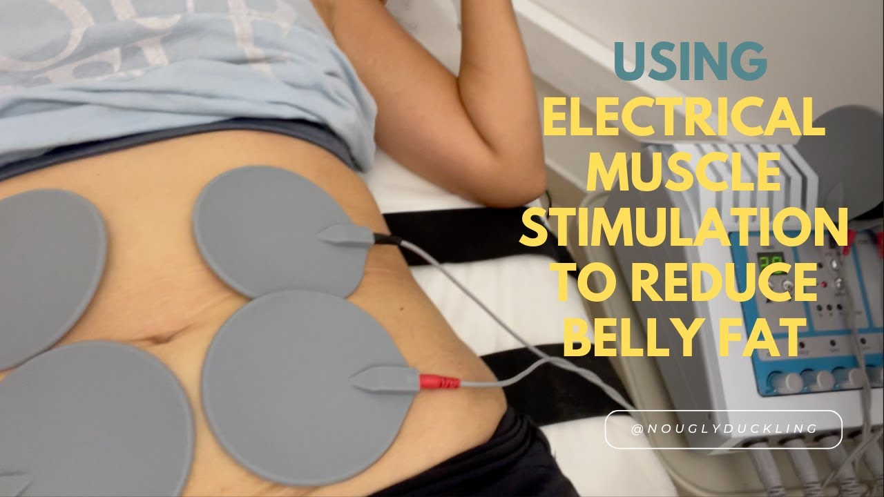 It Works! Reducing My Belly Fat with Electrostimulation!