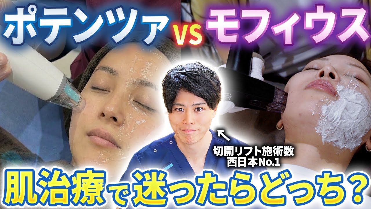 【最新版の肌治療】モフィウス8とポテンツァの違いを世界で一番分かりやすく解説します！【たるみ治療】