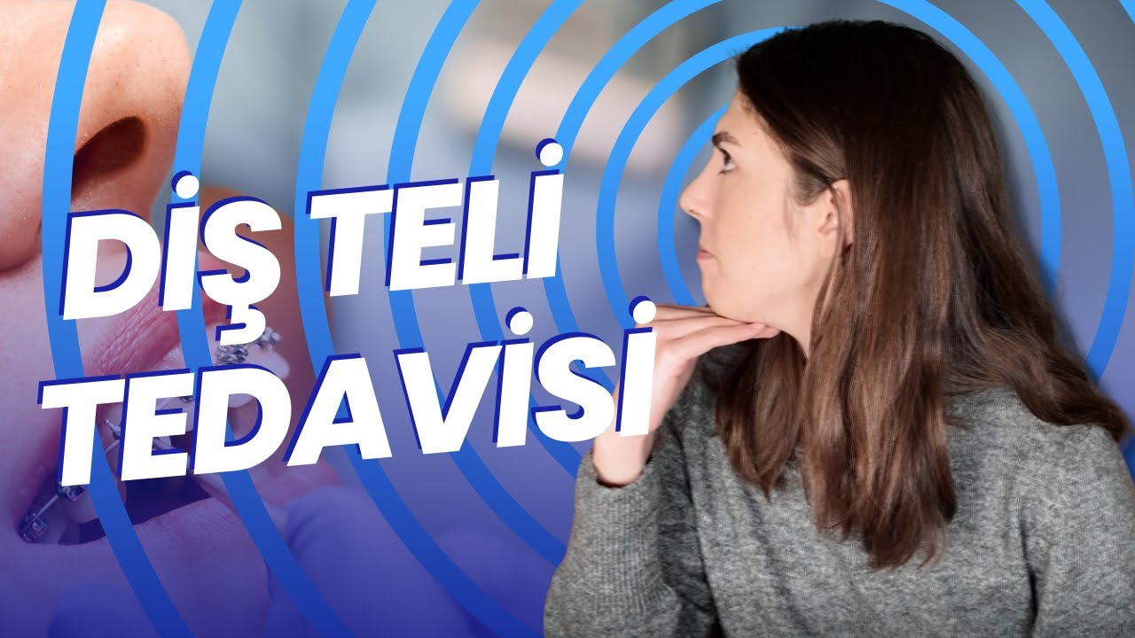 Diş Teli Tedavisi Sürecim: Acı mı? Zor mu? (Deneyimlerim)