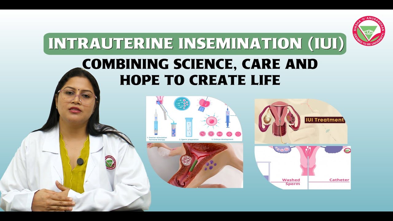 All you need to know about intrauterine insemination (IUI) | IMS & SUM Hospital