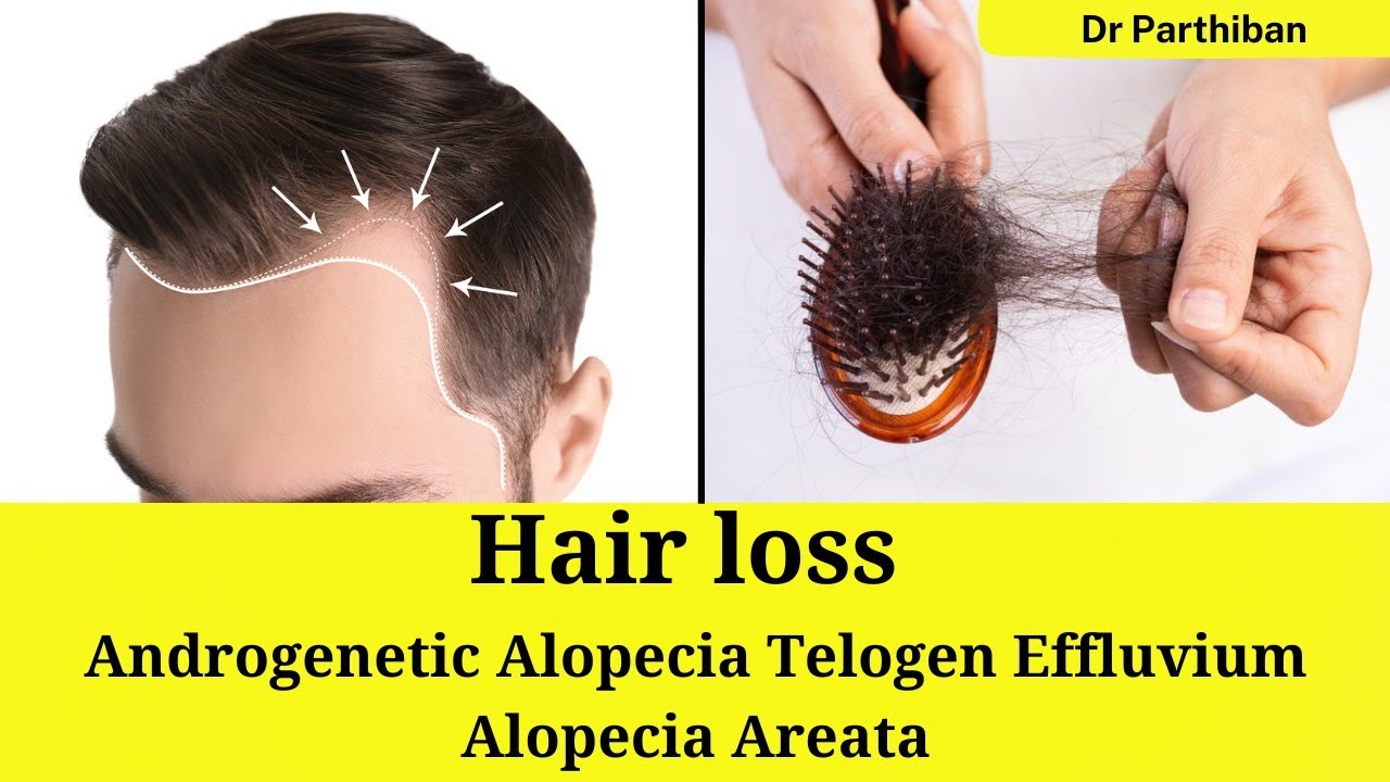 What are the type of hair loss