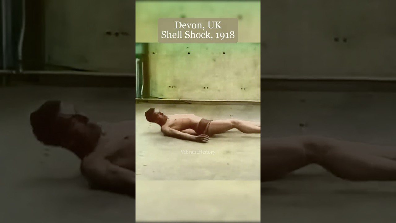 WWI Soldier With Shell Shock Gets Help #colorized #history