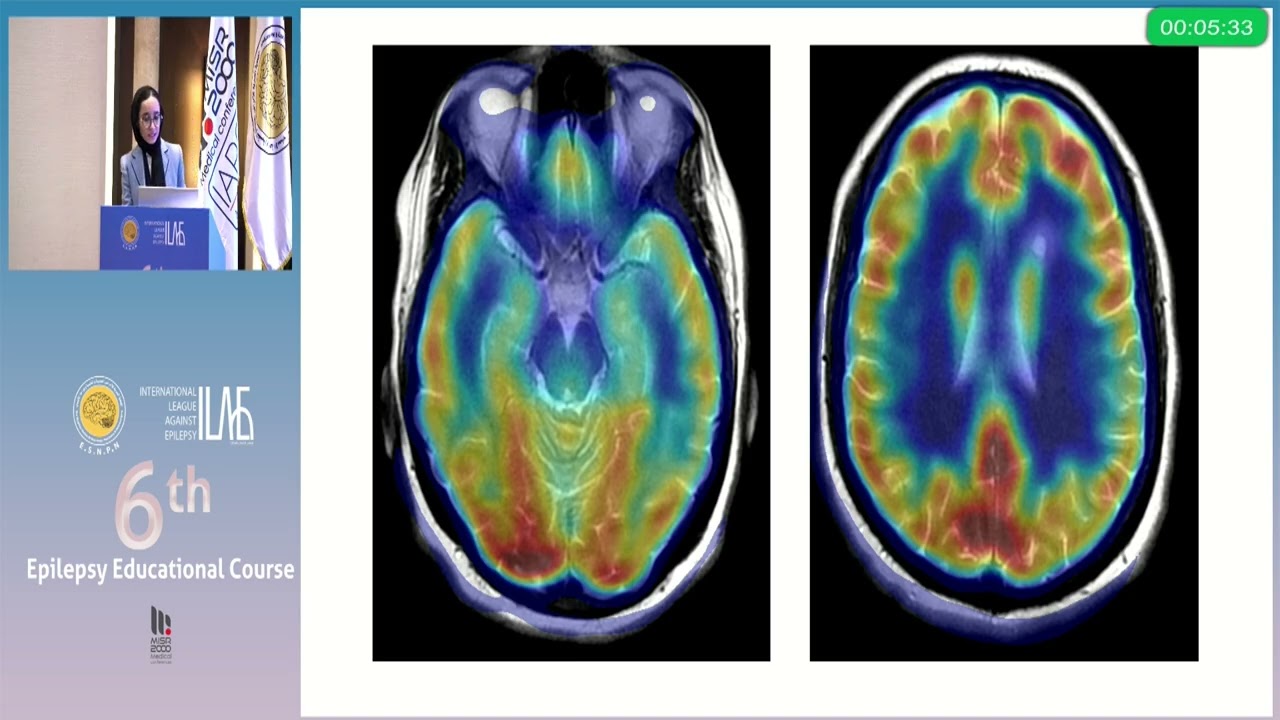 6th Epilepsy educational course Day1 P11