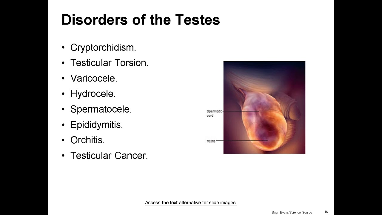 Mastering Medical Terminology Chapter 7: Male Reproductive System