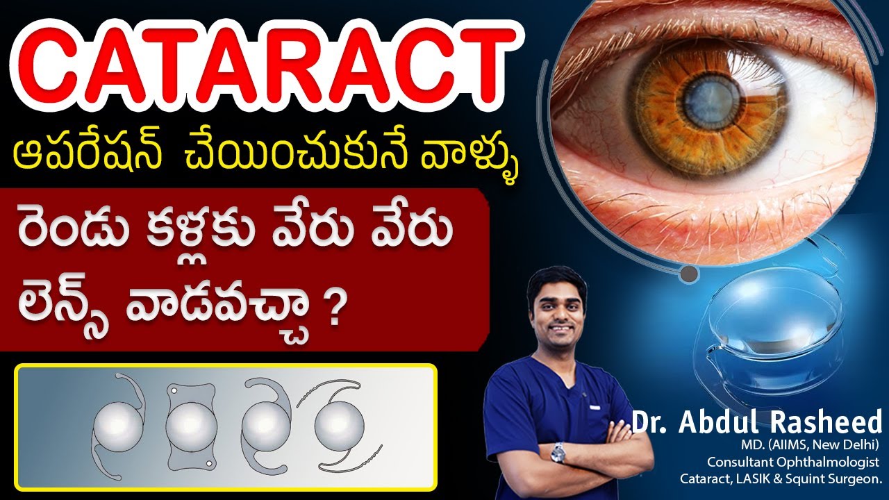 Can you have a different lens in each eye for cataract surgery | కంటిశుక్లం | Dr Abdul Rasheed