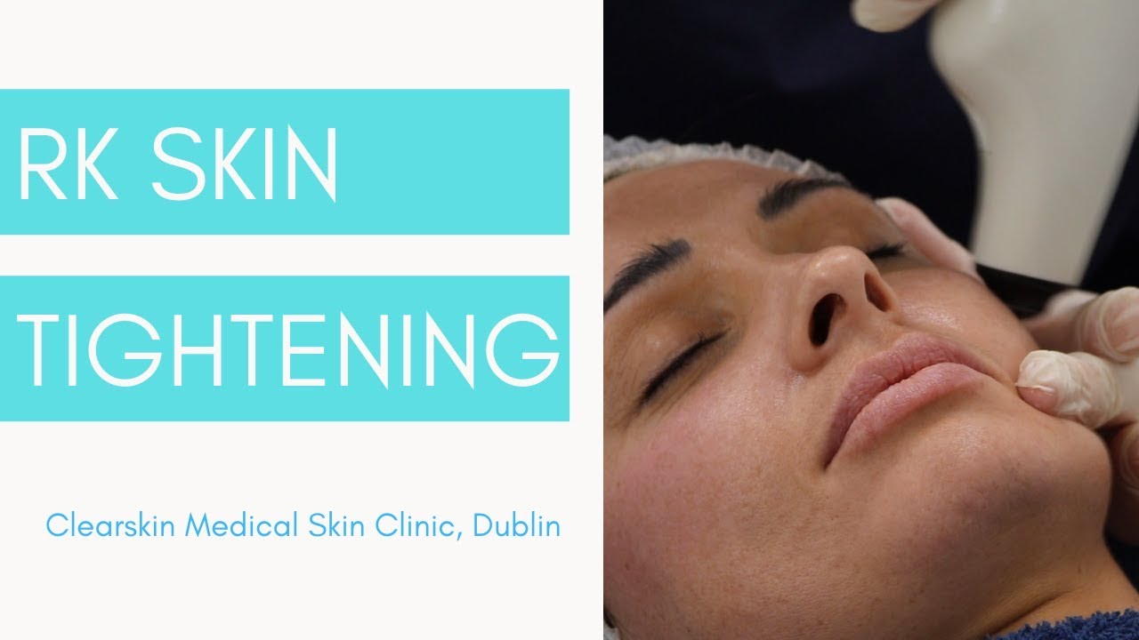 RF Skin Tightening at Clearskin Clinic Dublin