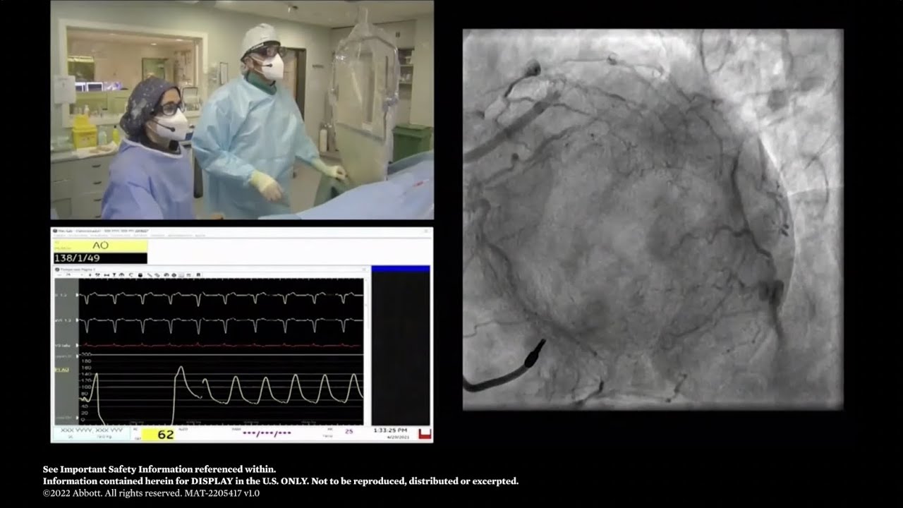 How OCT with Ultreon 1.0 Software Support in Guiding & Optimizing your Procedure: A Calcified Lesion