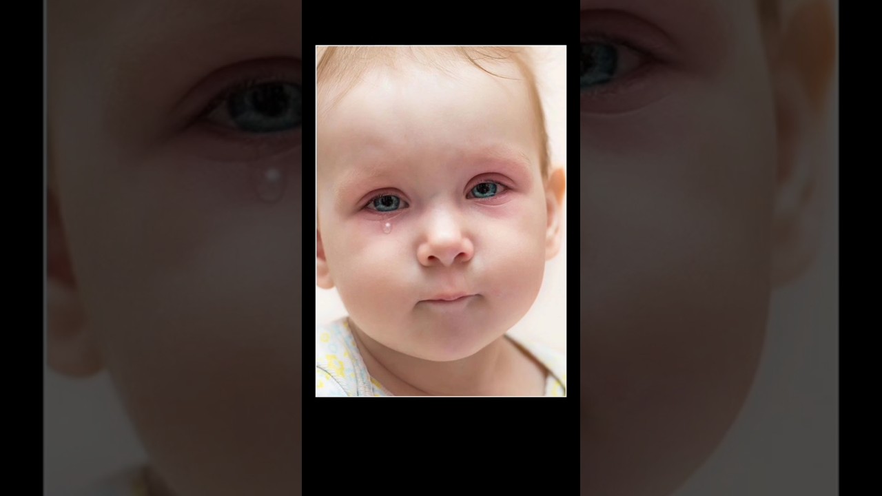 Pink Eye Infection Q28 of 50 | 