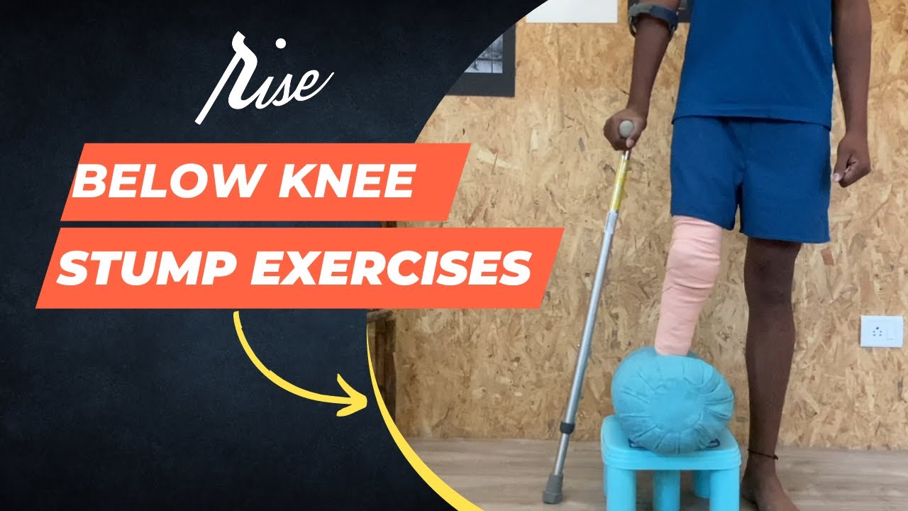 Below Knee Amputee Stump Exercises by Rise Bionics