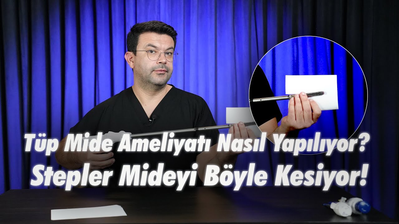 Tüp Mide Ameliyatı Nasıl Yapılıyor? Stepler Mideyi Böyle Kesiyor!