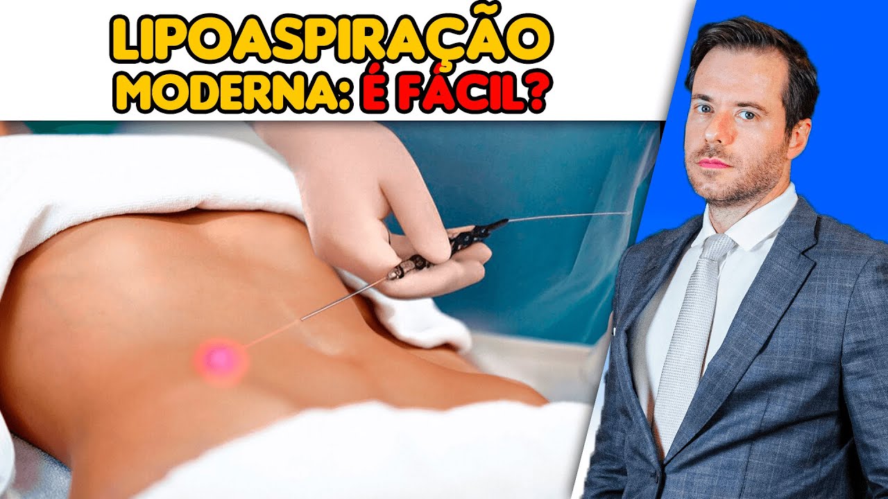 Lipoaspira&ccedil;&atilde;o Moderna: Como Modelar o Corpo com Naturalidade!