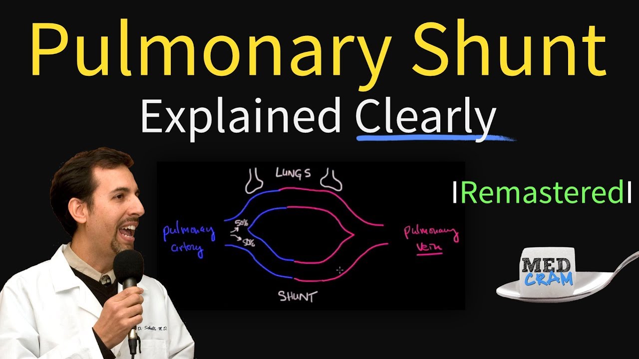 Shunting Explained Clearly (Pulmonary Shunt) - Remastered