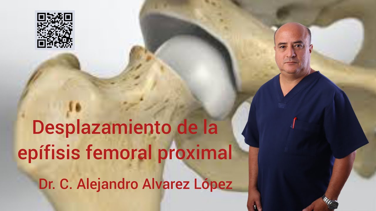 Desplazamiento de la epífisis femoral proximal