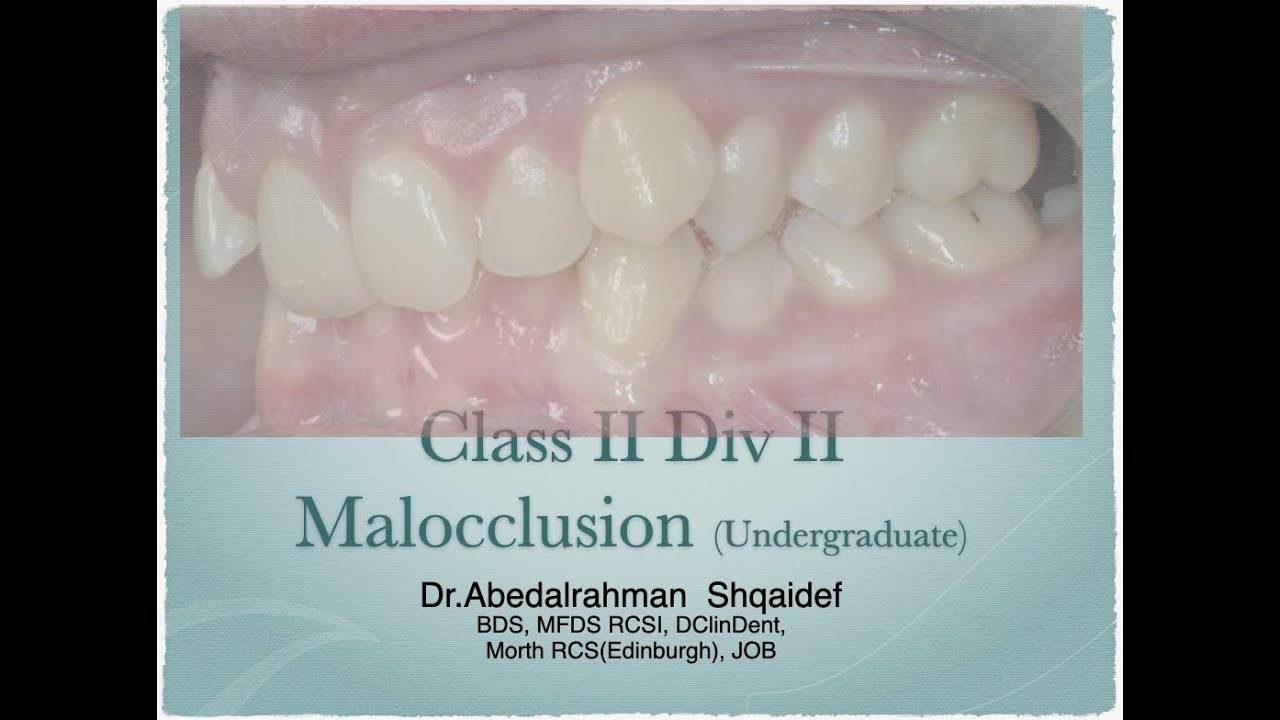 Class II div II (Undergraduate)