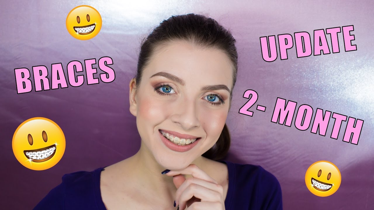 ☆БРЕКЕТИ☆ | 2 месеца update | Savisfaction Makeup