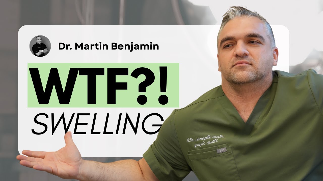 WTF?! Why Am I So Swollen After Surgery? | Dr. Benjamin Explains
