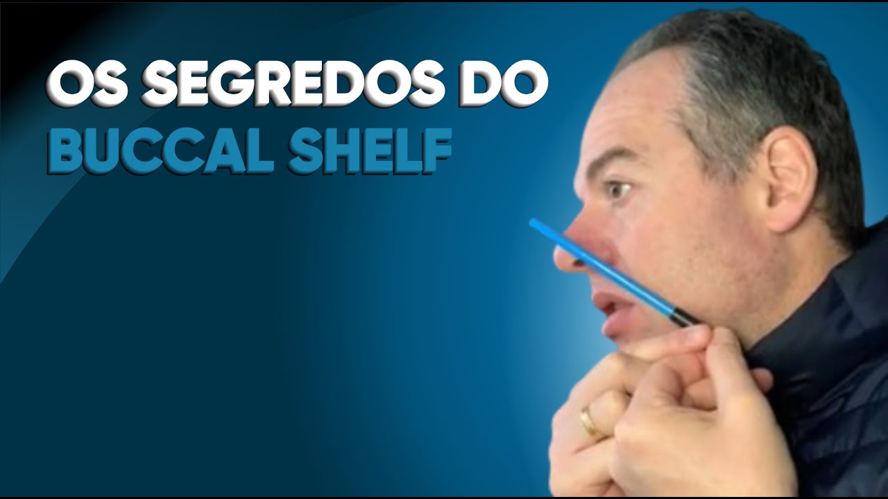 OS SEGREDOS DO BUCCAL SHELF OU SHELF MANDIBULAR I PROF. FABIO MICHELLETTI