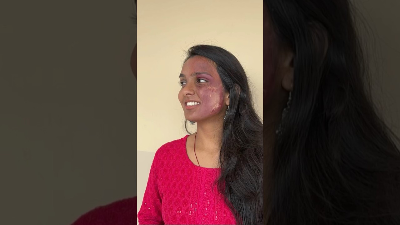 Behind scenes of ACID ATTACK NUKKAD NATAK🎭#trending#awareness#explore#acting #drama #college#share