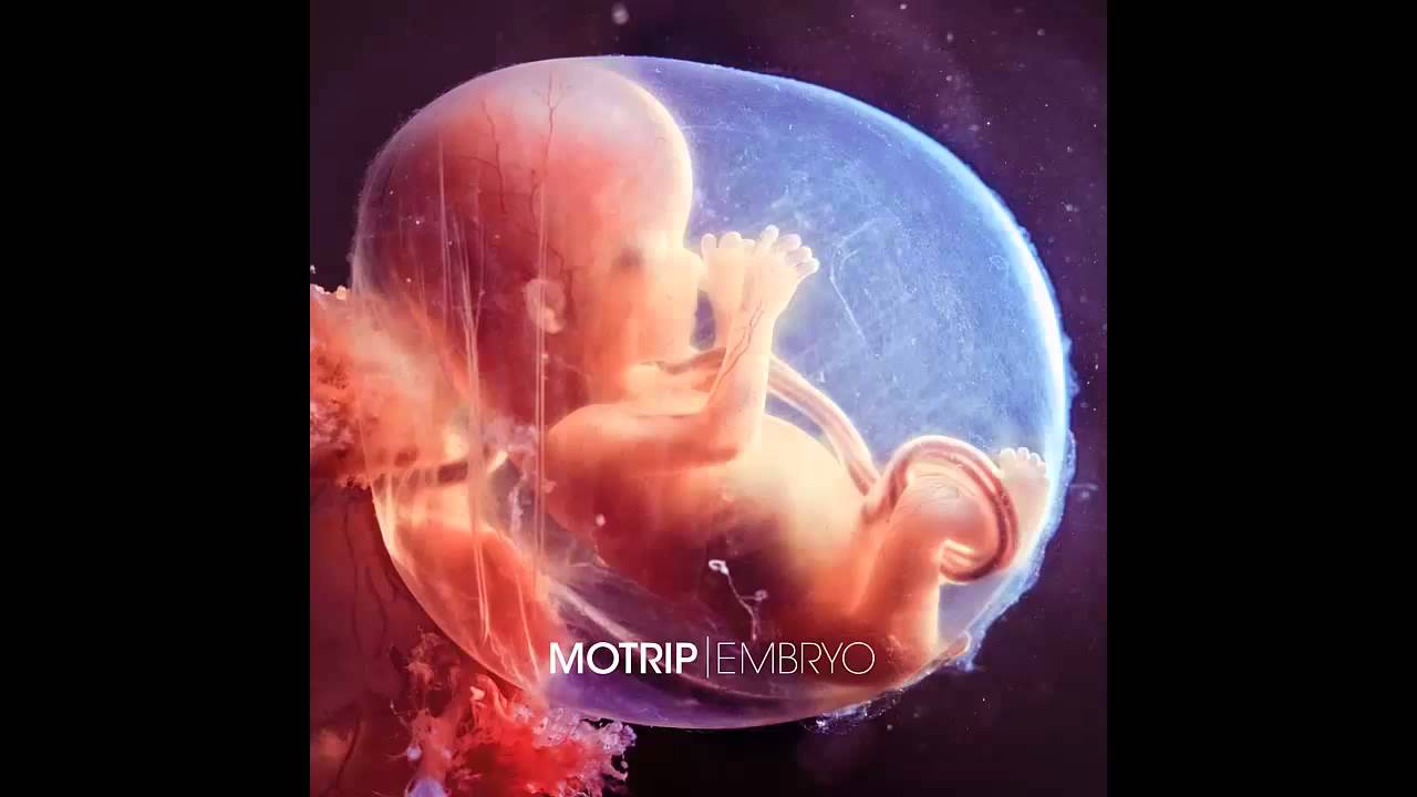 MOTRIP - DIE FRAGE IST WANN - EMBRYO - 06 [CDQ]