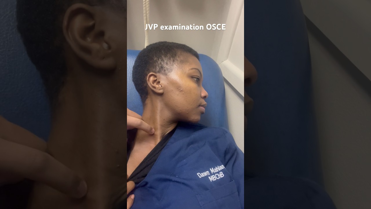 Обследование JVP для ОСКЭ. Определение давления в яремной вене. #osce #clinicalexamination #fyp