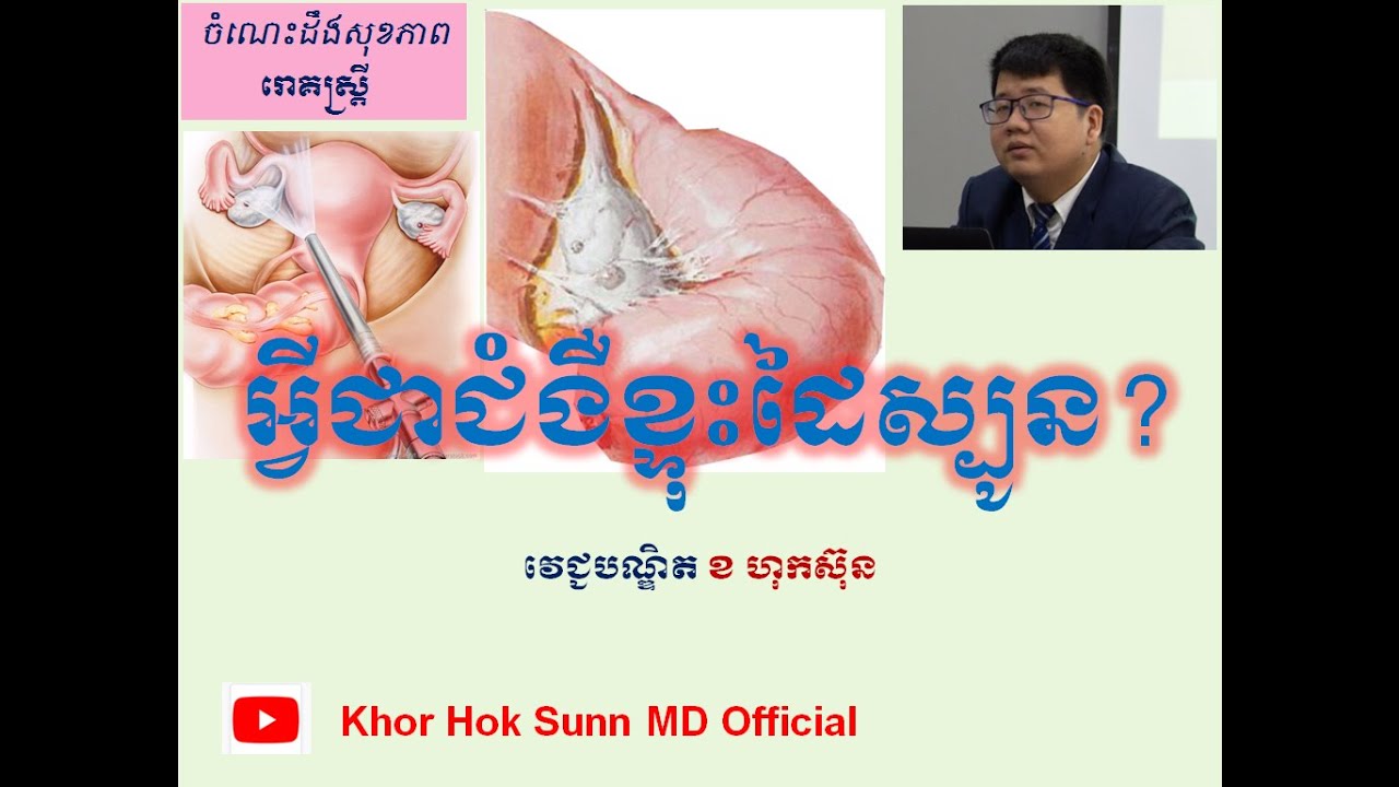 អ្វីជាជំងឺខ្ទុះដៃស្បូន?/What is pyosalpingx ? l Khor Hok Sunn MD Official