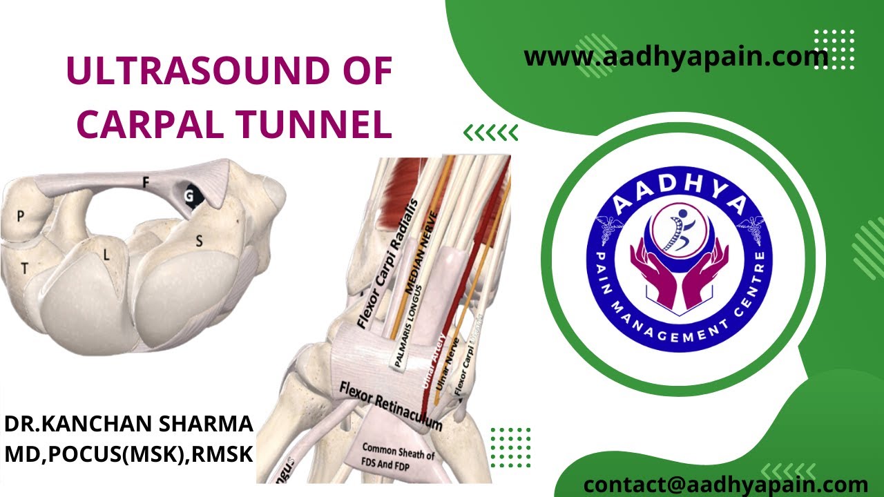 Ultrasound of Carpal Tunnel