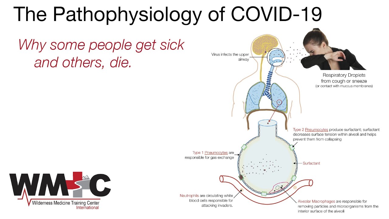 COVID 19 video Part 2 Pathophysiology, Signs, and Symptoms