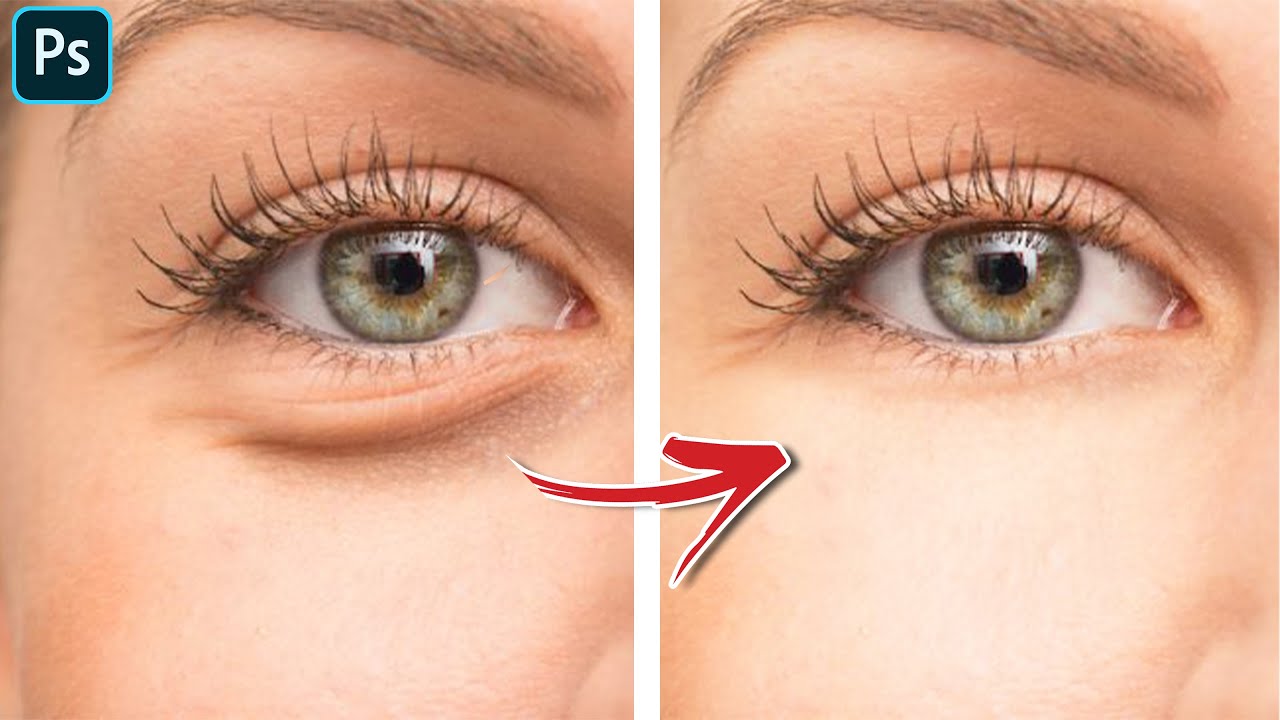 Photoshop Tutorial : Remove Eyebags Using This Technique  !