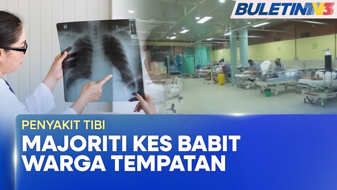 PENYAKIT TIBI | 85% Kes Babit Warga Tempatan (BU)