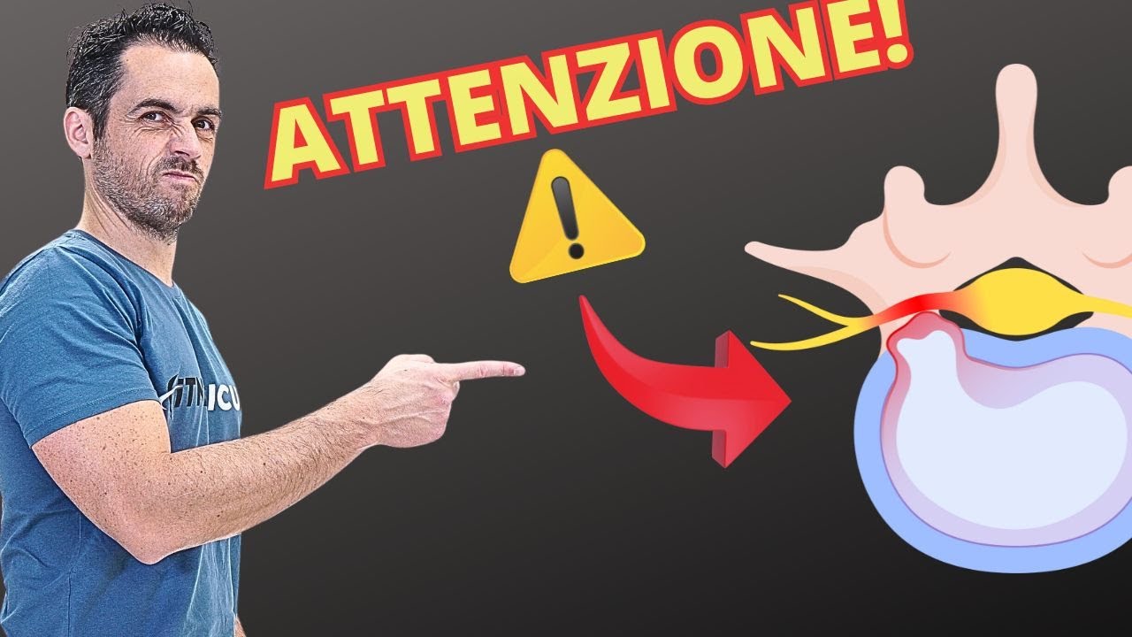 Sintomi PERICOLOSI di ERNIA al DISCO: presta attenzione!
