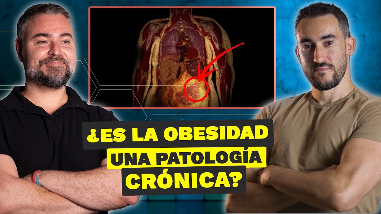 ¿Es LA OBESIDAD una patología crónica? - Charlando con un experto | Walter Suárez