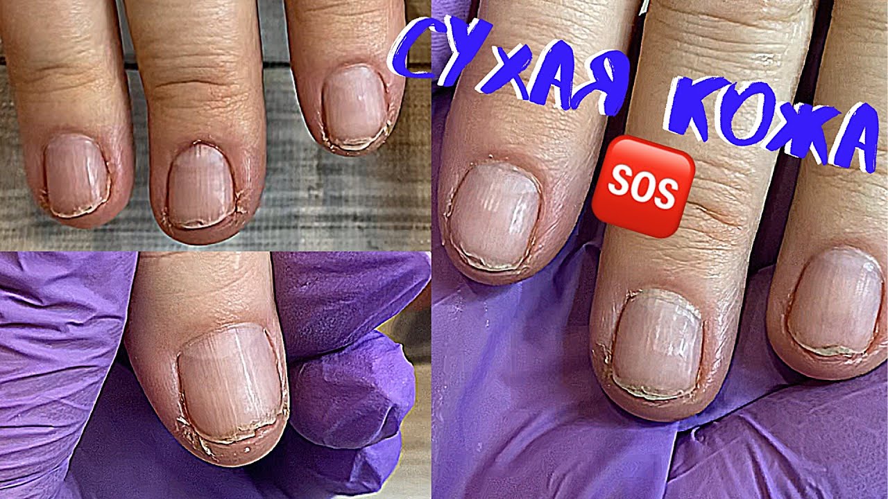 😱ЖУТКО СУХАЯ КОЖА❗️Как с такой работать⁉️|ТРЕЩИНЫ НА ПАЛЬЦАХ РУК| Возрастные руки