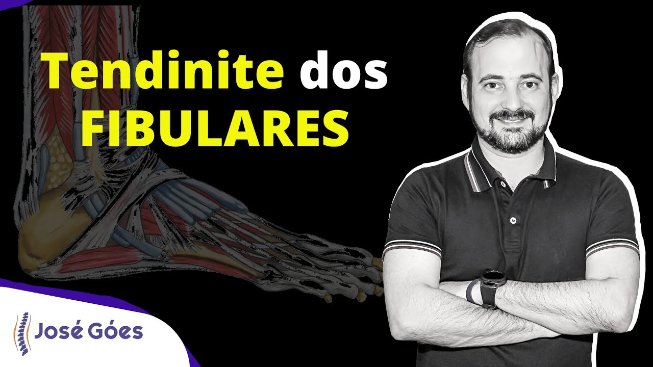 Tendinite dos FIBULARES  | José Góes