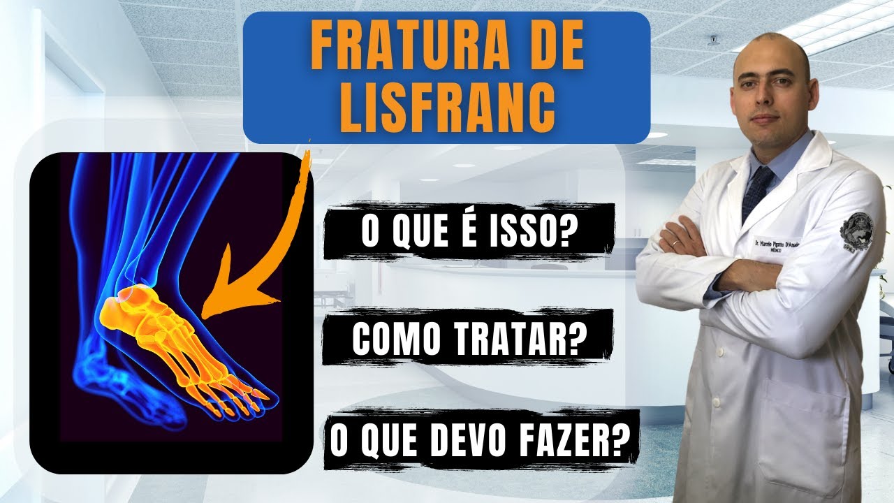 FRATURA DE LISFRANC | TUDO QUE SEU MÉDICO NÃO TE FALOU