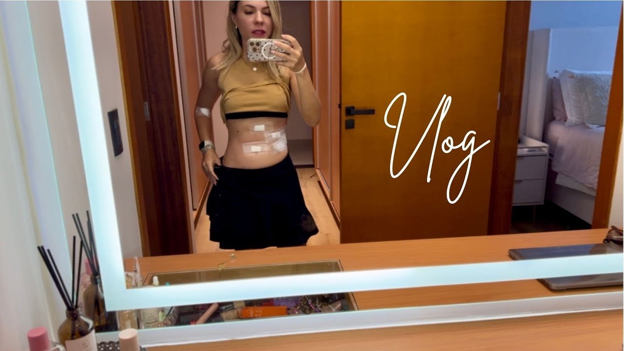 Minha cirurgia de vesícula - tinham muitas pedras ! 😱🪨