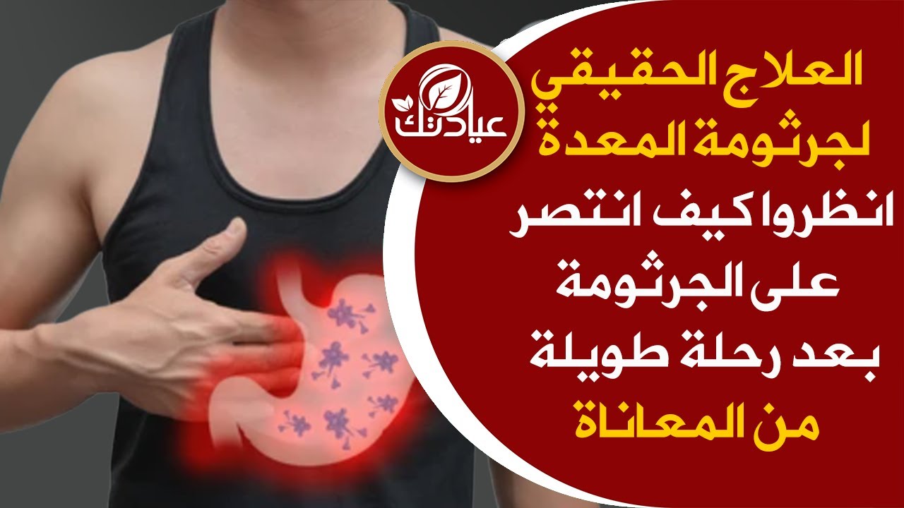 علاج جرثومة المعده السحري من الطبيعة وداعا للإمساك والغازات | عاني منها لسنوات وعلاجه كان مفاجآة